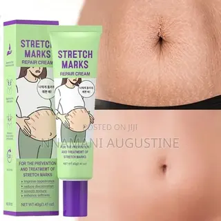 Stretch Marks Removal Cream