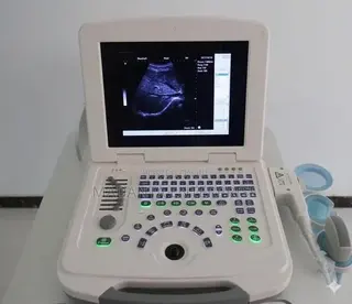 Ultrasound Scan Machine