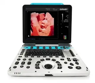 Ultrasound Scan Machine (Dawe)