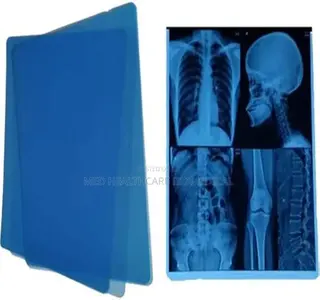X-Ray Blue Films