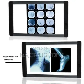 X-Ray View Box Double