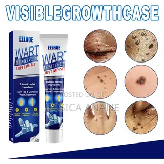 Eelhoe Skin Tags and Warts Remover Ointment