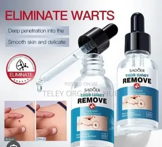 Skin Tag/Wartt