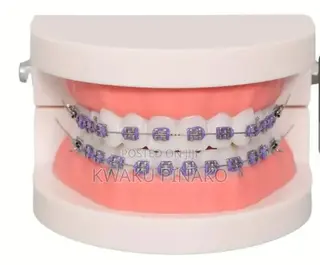 Fashion Braces for-Sale Cool Price