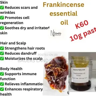 Frankincense Essential Oil