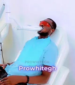 Effective Instant Teeth Whitening Service