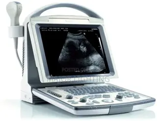 Ultra Sound Scanning Machine