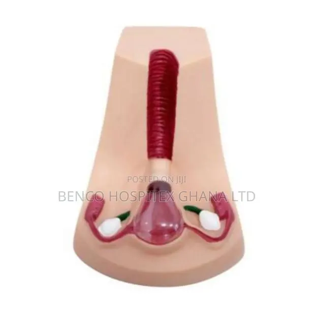 Contraceptive Device Model · Photo 1