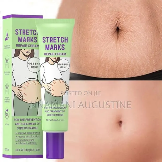 Stretch Marks Removal Cream · Photo 1