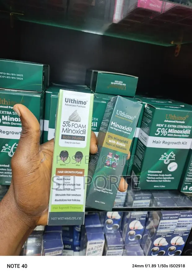 Ulthimo Minoxidil Hair Growth Treatment · Photo 1