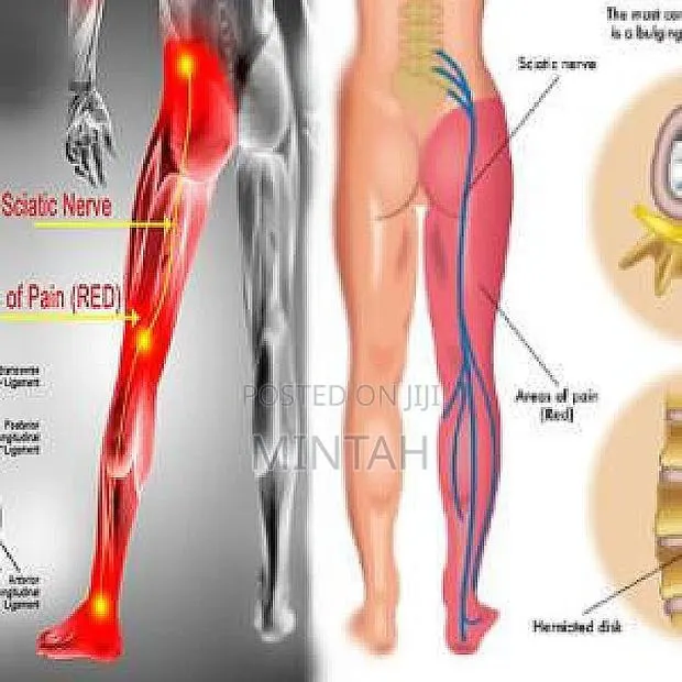 Back and Leg Nerve Comfort Support Pack