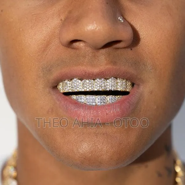 Iced Grillz · Photo 1