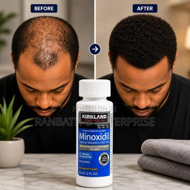 Buy Original Kirkland Minoxidil in Ghana · Photo 1