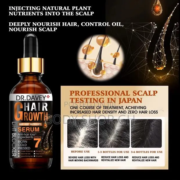 DHT Blocker Oil - Stops Hair Loss, Strengthens and Regrow Hair · Photo 1