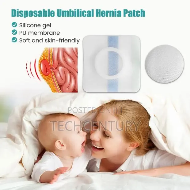 Baby Umbilical Hernia Patch · Photo 2