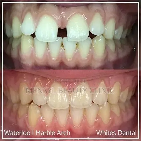 Professional Dental Braces Correction of Alignment Orthodontic · Photo 3