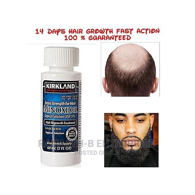 Undiluted 5% Kirkland Minoxidil · Photo 1