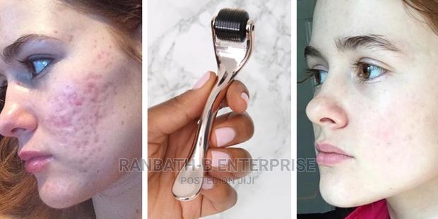 Derma Roller · Photo 1