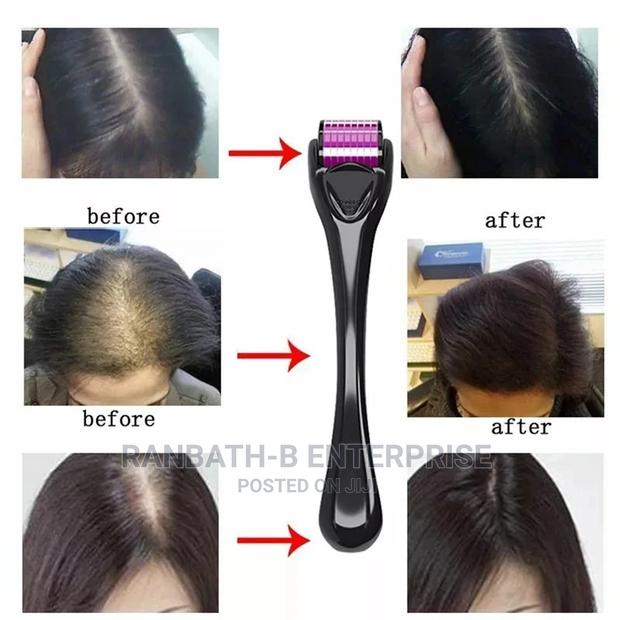 Derma Hair Roller System (0.5mm) · Photo 1