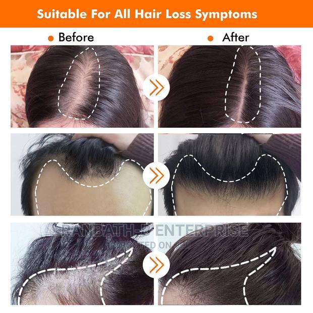 Derma Hair Roller System (0.5mm) · Photo 2