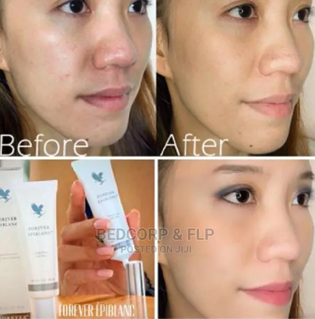 Forever Epiblanc Dark Spots Clearer · Photo 1