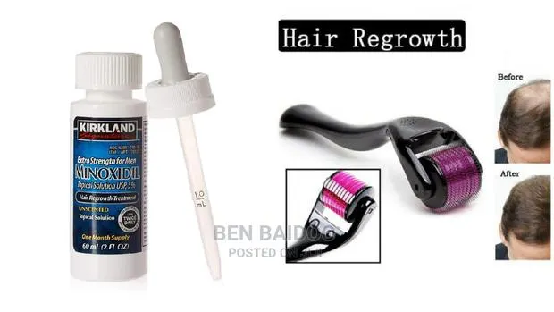 Kirkland Minoxidil Oil And Derma Roller 0.5mm · Photo 1