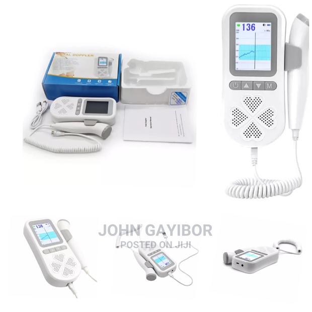Quality Fetal Doppler/Fetoscope With Warranty+ Free Scan Gel · Photo 1
