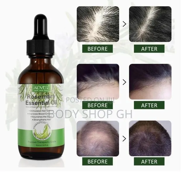 Rosemary Oil for Hair and Edges Growth - Reduce Hair Loss · Photo 1