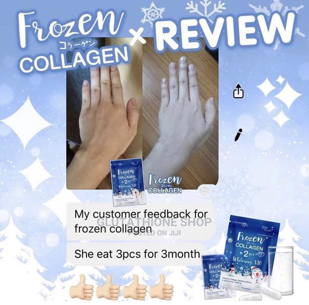 Frozen Plus Collagen Whitening Set Supplement · Photo 4