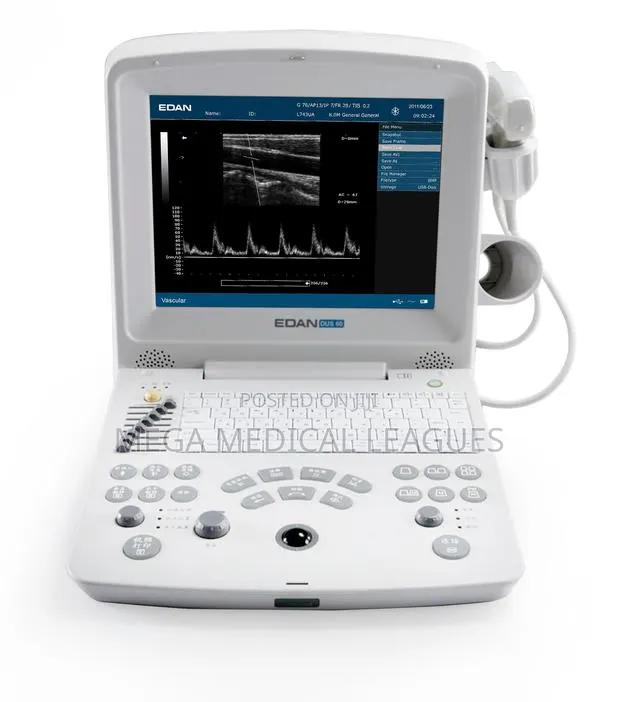Edan DUS60 Black and White Ultrasound · Photo 1