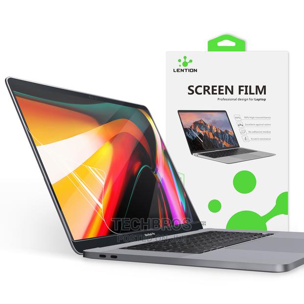 Screen Protector for Macbooks · Photo 1