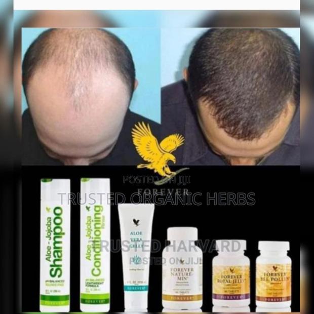 Baldness Or Hair Loss · Photo 1