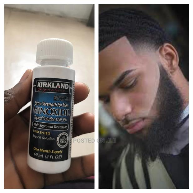 Original Kirkland Minoxidil · Photo 1