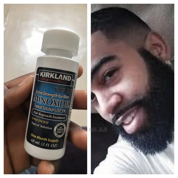 Leo Kirkland Minoxidil Oil · Photo 1