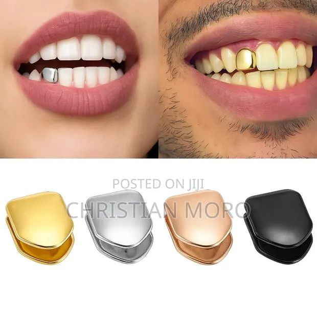 Tooth Crown · Photo 1