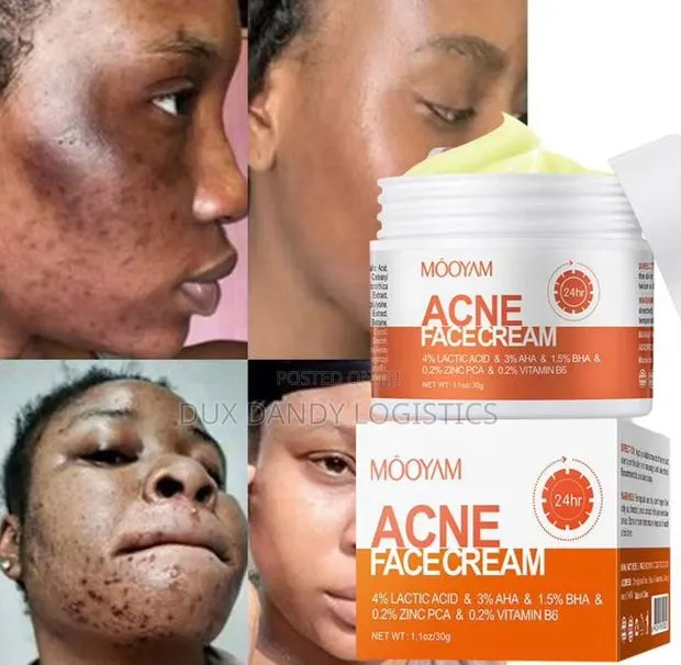 Acne Face Cream · Photo 1