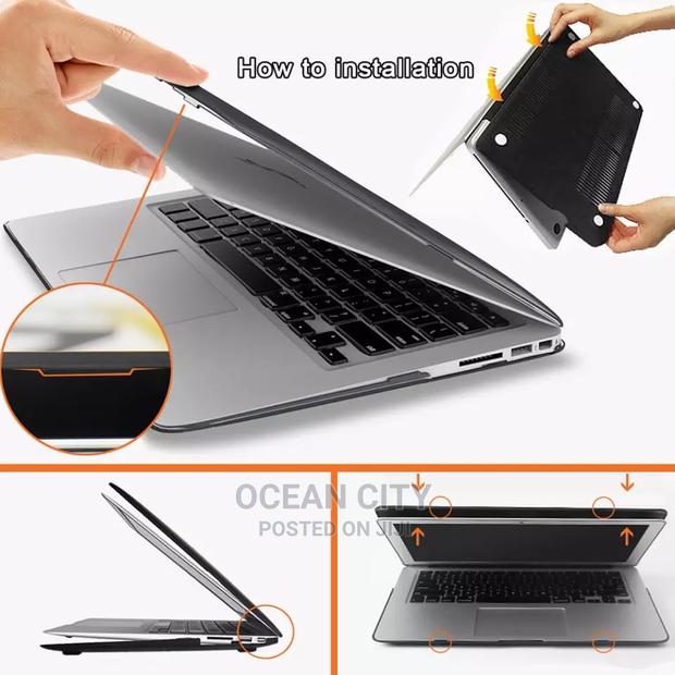 14” Macbook Case Bundle (3-in-1) · Photo 2