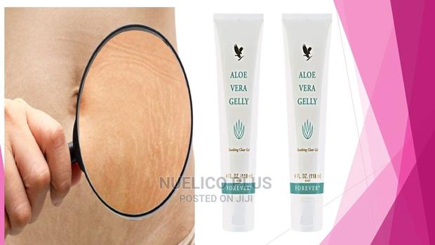 Aloe Gelly for Strech Marks · Photo 1