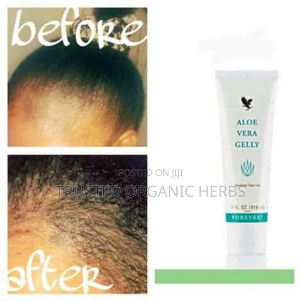 Hair Growth or Hair Loss Treatment · Photo 1