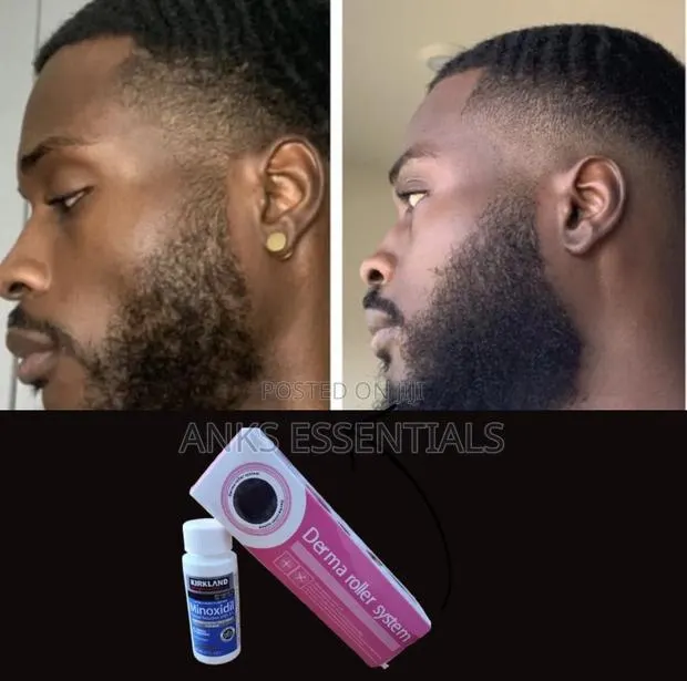 Hair Growth Treatment – Kirkland Oil + Roller · Photo 1