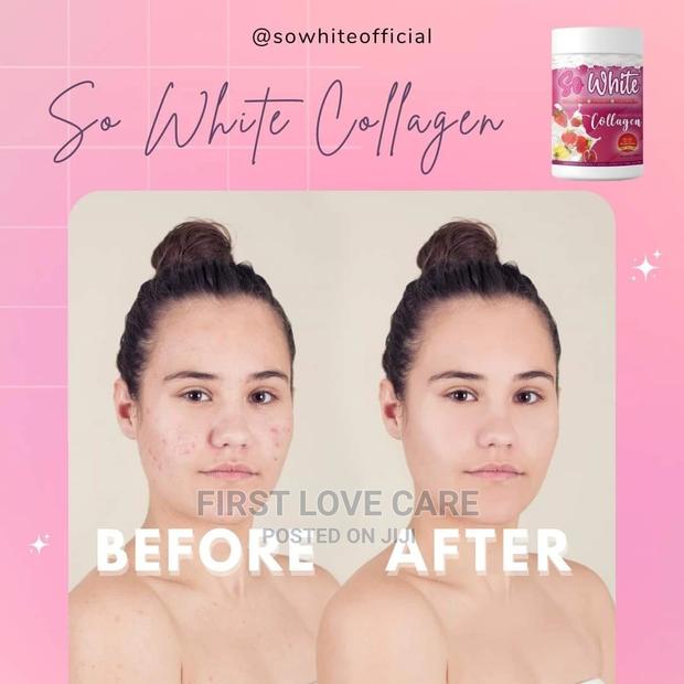 So White Collagen So White Gluta Pearl · Photo 7