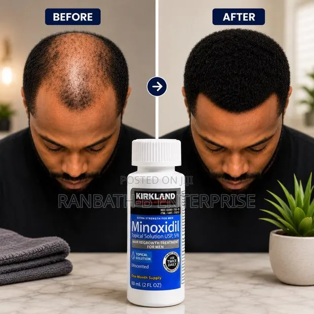 Shop Original Kirkland Minoxidil · Photo 1