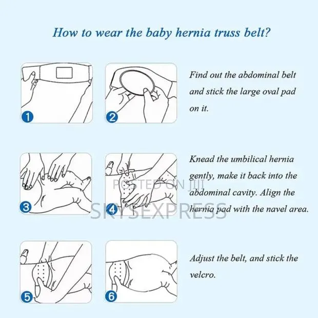 Baby Umbilical Hernia Belt · Photo 2