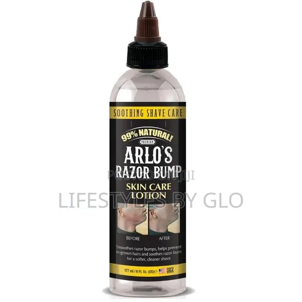 Arlo's Razor Bump Skin Care Lotion