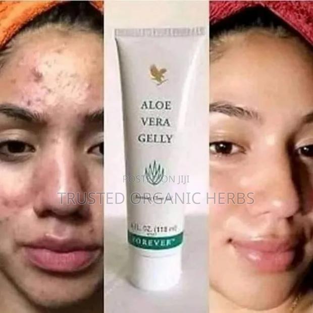 Forever Aloe Gelly - Soothes Clear Gel · Photo 1