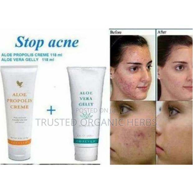 Forever Aloe Propolis Skincare · Photo 1