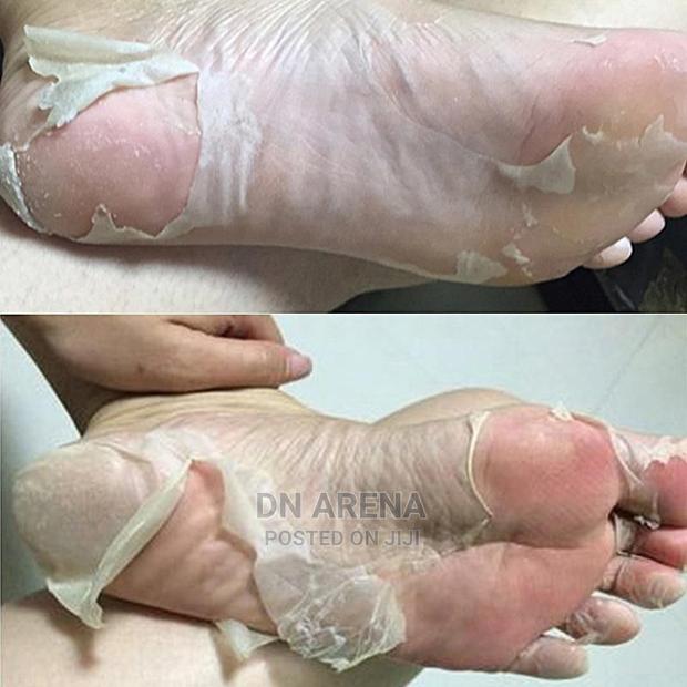 Foot Mask / Dead Skin Cells Remover · Photo 3
