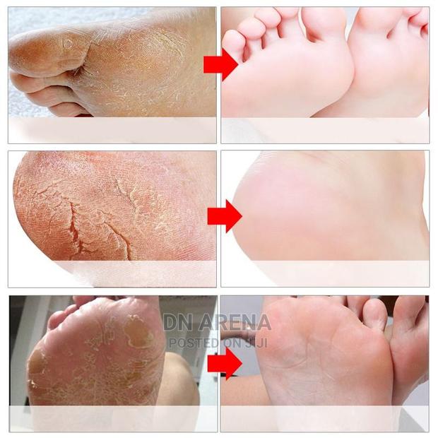 Foot Mask / Dead Skin Cells Remover · Photo 4