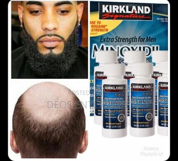 Kirkland Minoxibeard · Photo 1