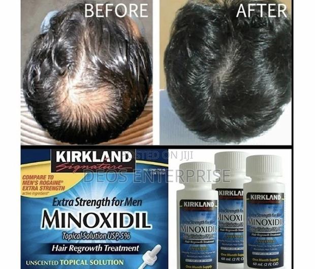 Kirkland Minoxidil · Photo 2